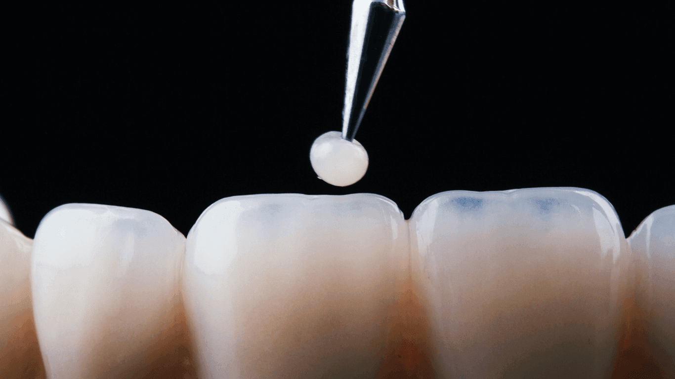 Fillings